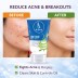 B.ONE Anti Acne Facewash | Clear & Fresh Skin